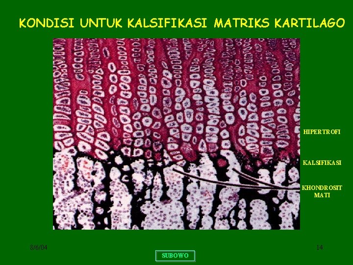 KONDISI UNTUK KALSIFIKASI MATRIKS KARTILAGO HIPERTROFI KALSIFIKASI KHONDROSIT MATI 8/6/04 14 SUBOWO 