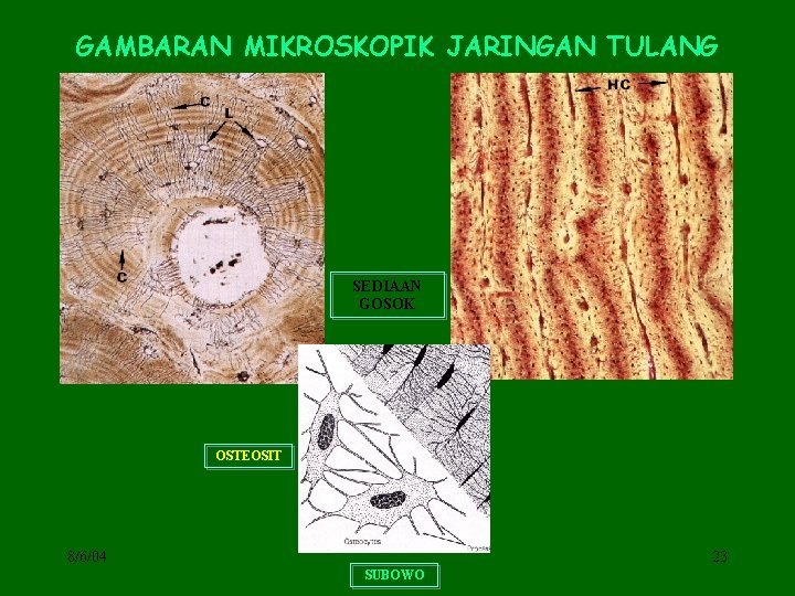 GAMBARAN MIKROSKOPIK JARINGAN TULANG SEDIAAN GOSOK OSTEOSIT 8/6/04 23 SUBOWO 