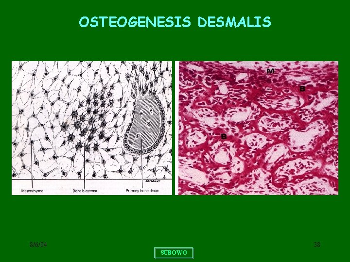 OSTEOGENESIS DESMALIS 8/6/04 38 SUBOWO 