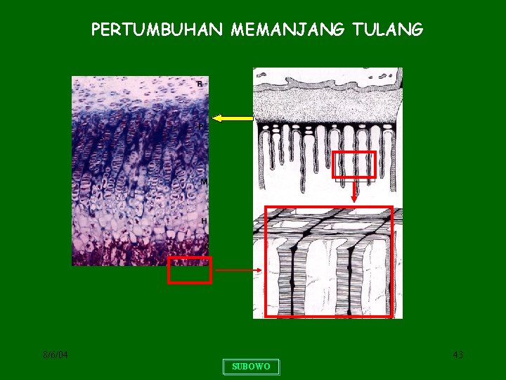 PERTUMBUHAN MEMANJANG TULANG 8/6/04 43 SUBOWO 