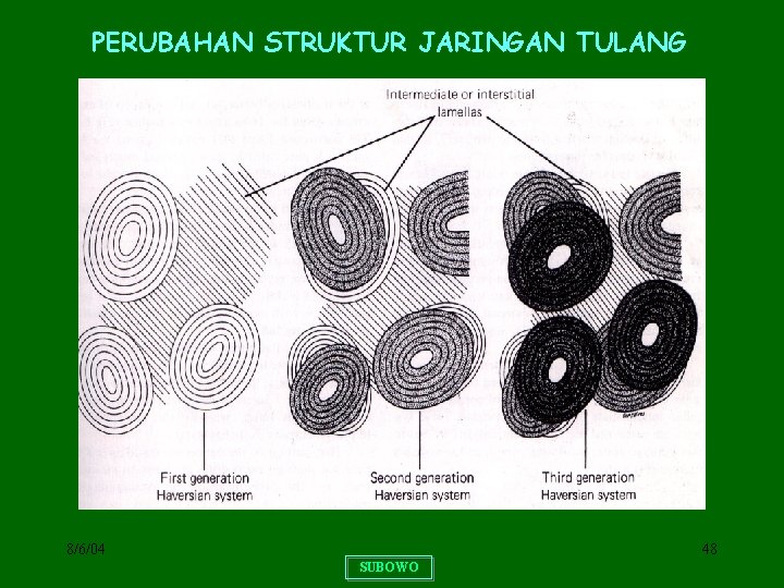 PERUBAHAN STRUKTUR JARINGAN TULANG 8/6/04 48 SUBOWO 