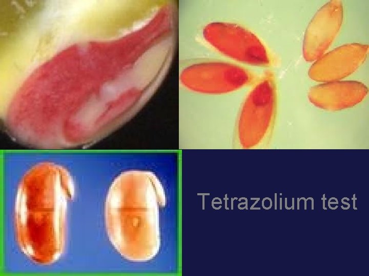 Tetrazolium test 