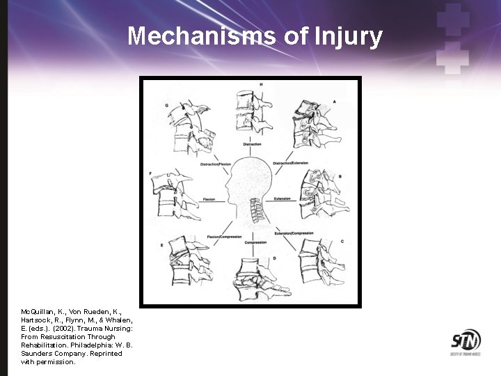 Mechanisms of Injury Mc. Quillan, K. , Von Rueden, K. , Hartsock, R. ,