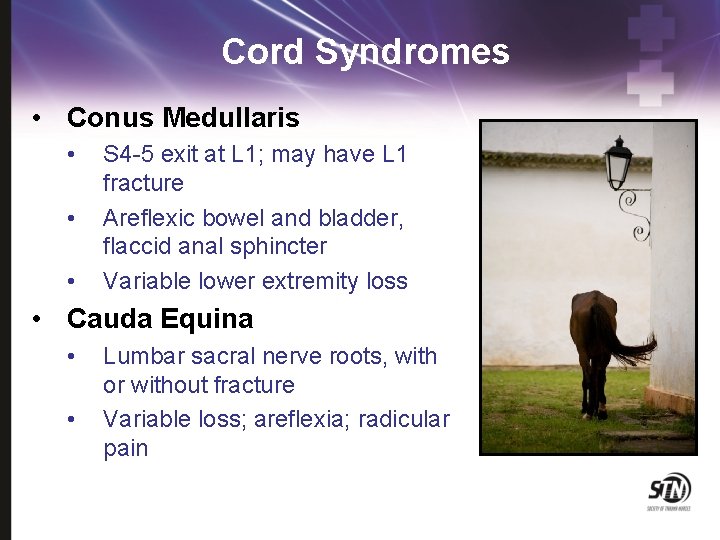 Cord Syndromes • Conus Medullaris • • • S 4 -5 exit at L