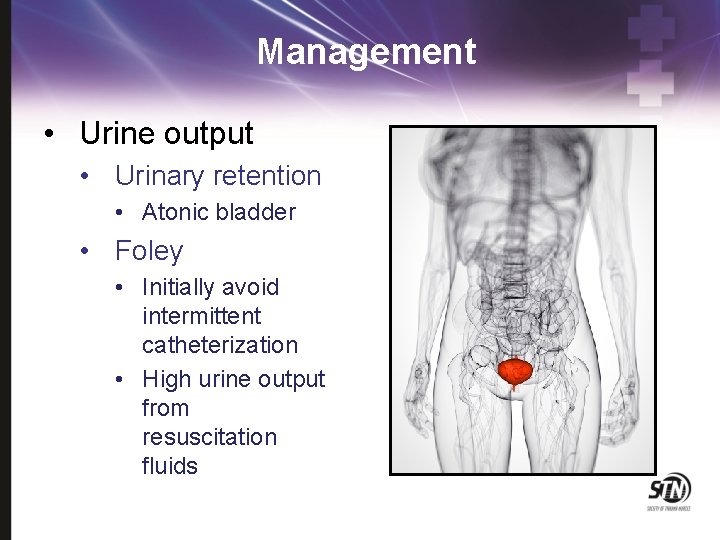 Management • Urine output • Urinary retention • Atonic bladder • Foley • Initially