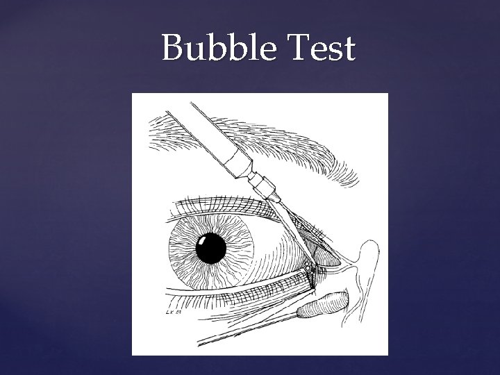 Bubble Test 