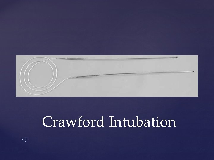 Crawford Intubation 17 
