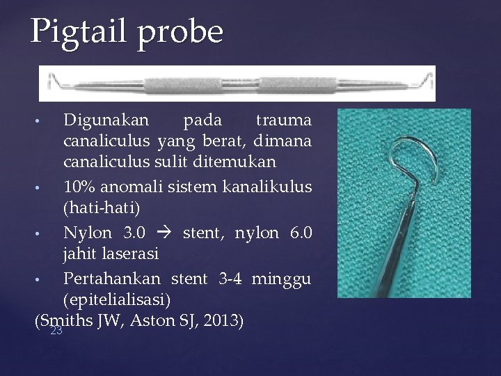 Pigtail probe Digunakan pada trauma canaliculus yang berat, dimana canaliculus sulit ditemukan • 10%