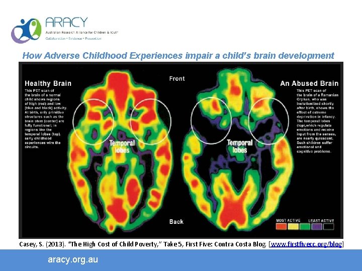 How Adverse Childhood Experiences impair a child’s brain development Early childhood home environment predicts