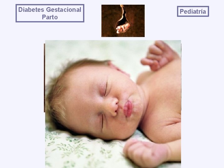 Diabetes Gestacional Parto Pediatría 