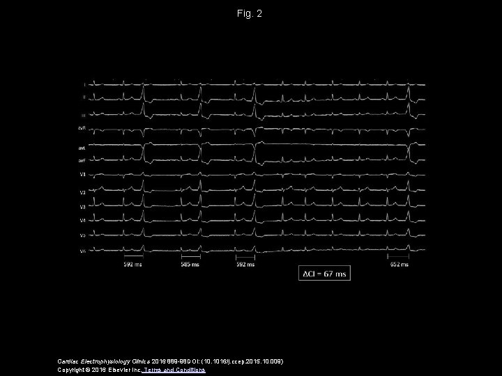 Fig. 2 Cardiac Electrophysiology Clinics 2016 889 -98 DOI: (10. 1016/j. ccep. 2015. 10.