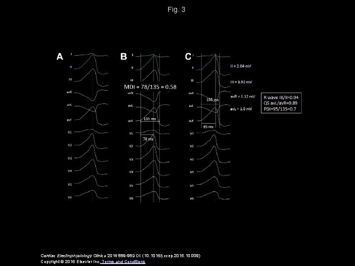 Fig. 3 Cardiac Electrophysiology Clinics 2016 889 -98 DOI: (10. 1016/j. ccep. 2015. 10.