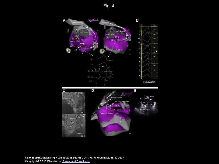 Fig. 4 Cardiac Electrophysiology Clinics 2016 889 -98 DOI: (10. 1016/j. ccep. 2015. 10.