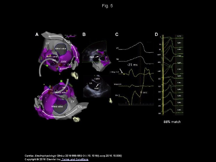 Fig. 5 Cardiac Electrophysiology Clinics 2016 889 -98 DOI: (10. 1016/j. ccep. 2015. 10.