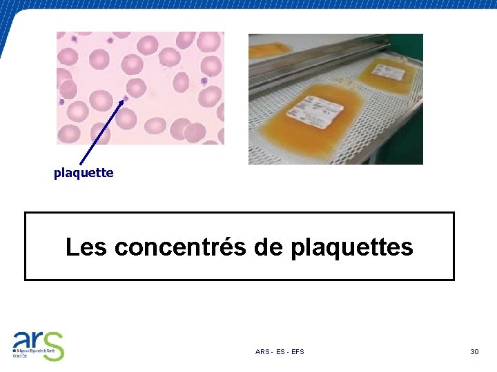 plaquette Les concentrés de plaquettes ARS - EFS 30 