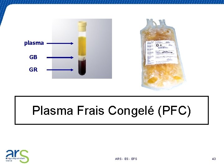 plasma GB GR Plasma Frais Congelé (PFC) ARS - EFS 43 