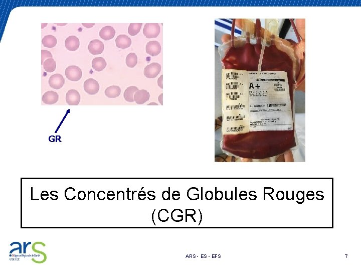 GR Les Concentrés de Globules Rouges (CGR) ARS - EFS 7 