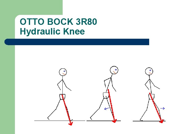 OTTO BOCK 3 R 80 Hydraulic Knee 