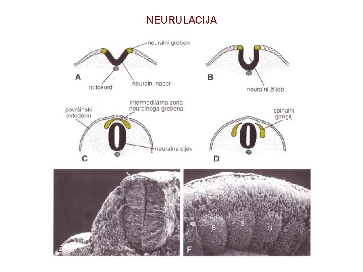 NEURULACIJA 