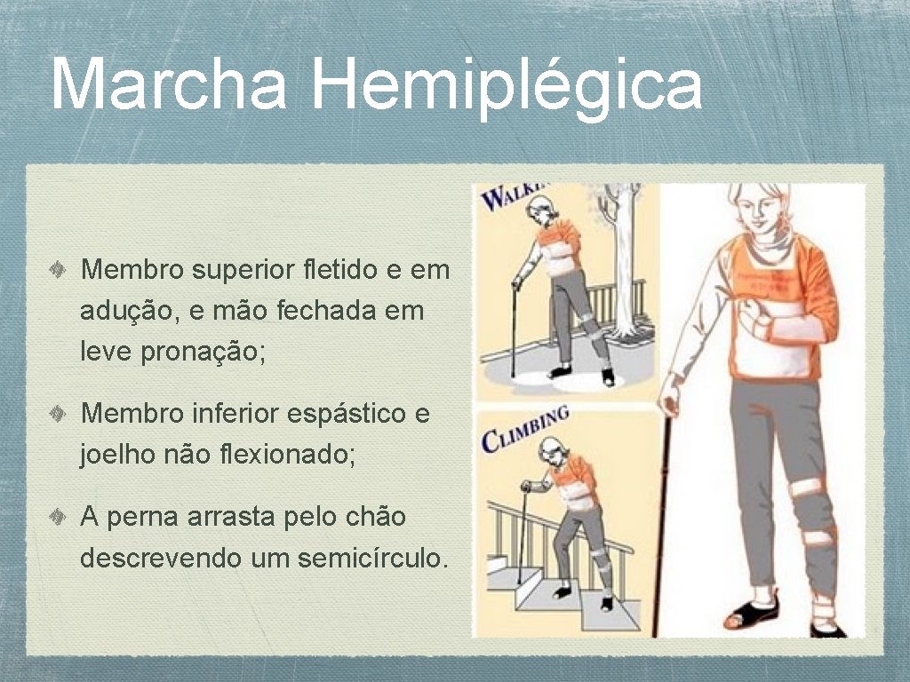 Marcha Hemiplégica Membro superior fletido e em adução, e mão fechada em leve pronação;