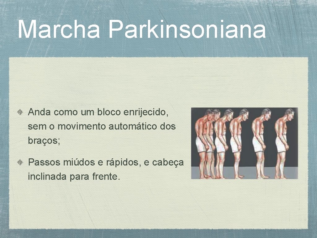 Marcha Parkinsoniana Anda como um bloco enrijecido, sem o movimento automático dos braços; Passos