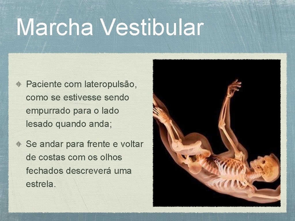Marcha Vestibular Paciente com lateropulsão, como se estivesse sendo empurrado para o lado lesado