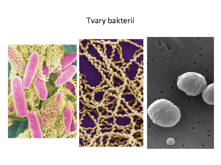 Tvary bakterií 