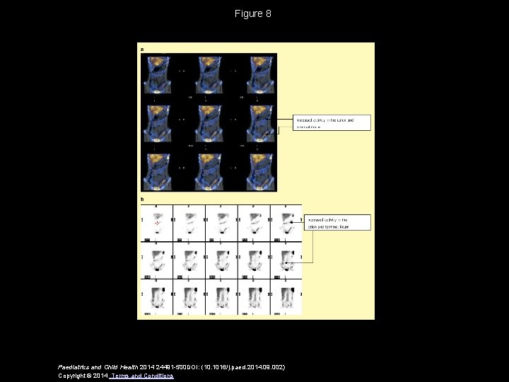 Figure 8 Paediatrics and Child Health 2014 24491 -500 DOI: (10. 1016/j. paed. 2014.