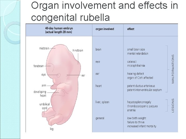Organ involvement and effects in congenital rubella 