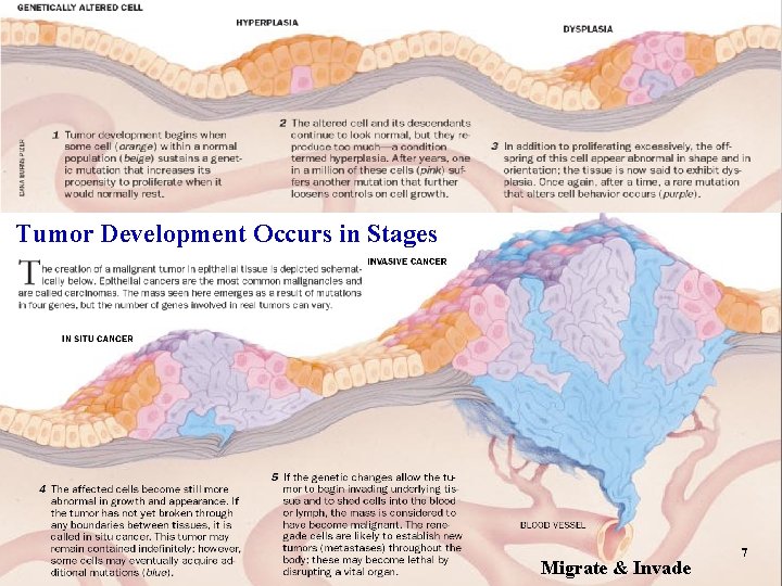 Tumor Development Occurs in Stages Migrate & Invade 7 