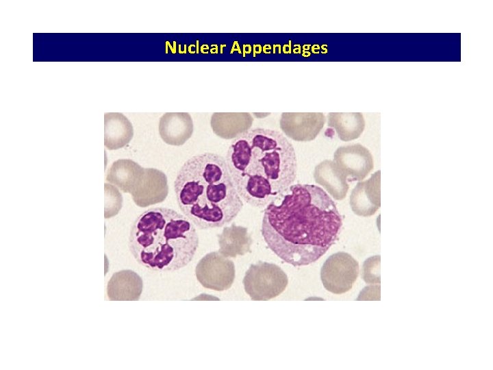 Nuclear Appendages Nuclear Appendages