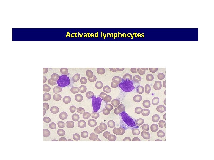 Activated lymphocytes Activated lymphocytes