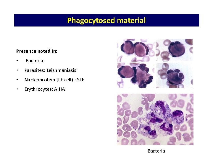 Phagocytosed material Presence noted in; • Bacteria • Parasites: Leishmaniasis • Nucleoprotein (LE cell) Phagocytosed material Presence noted in; • Bacteria • Parasites: Leishmaniasis • Nucleoprotein (LE cell)