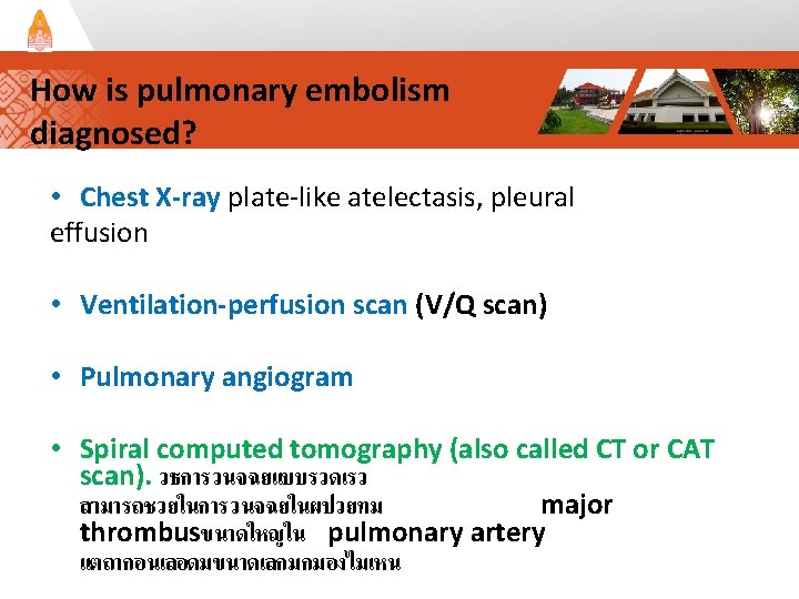 How is pulmonary embolism diagnosed? • Chest X-ray plate-like atelectasis, pleural effusion • Ventilation-perfusion