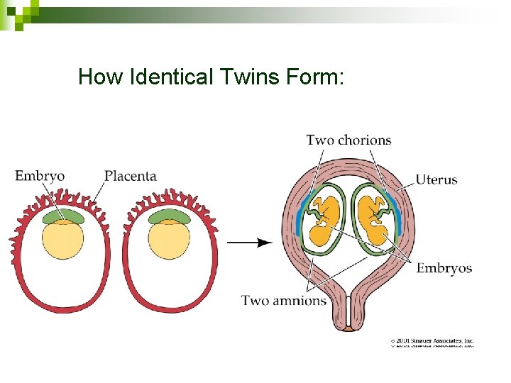 How Identical Twins Form: 