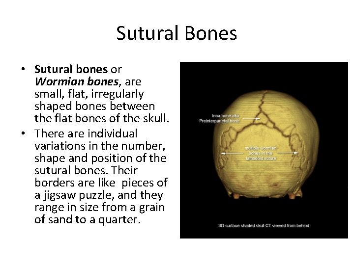 Sutural Bones • Sutural bones or Wormian bones, are small, flat, irregularly shaped bones