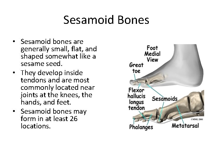 Sesamoid Bones • Sesamoid bones are generally small, flat, and shaped somewhat like a