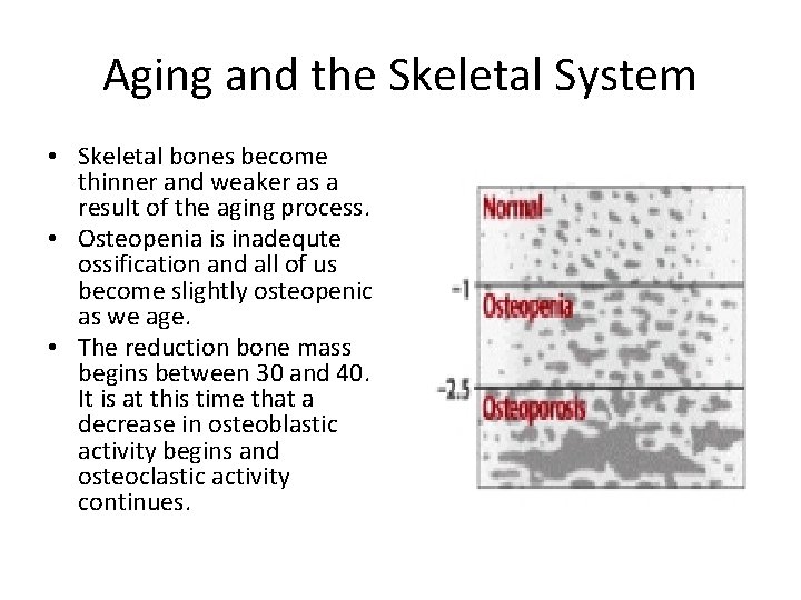Aging and the Skeletal System • Skeletal bones become thinner and weaker as a