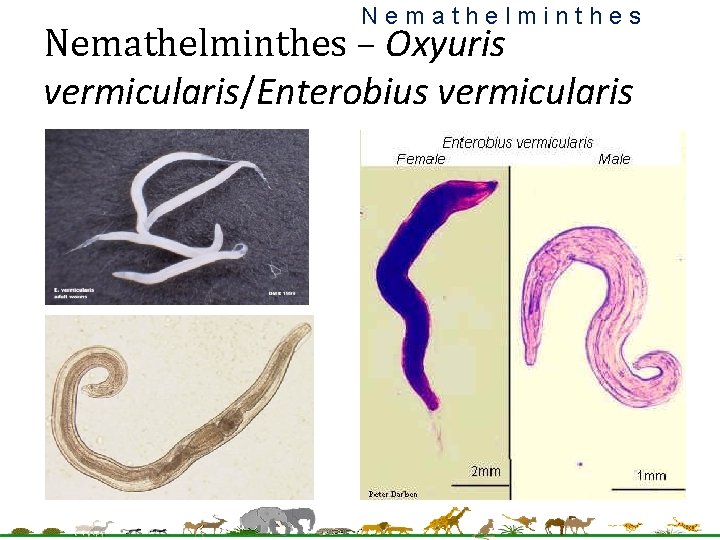 Nemathelminthes – Oxyuris vermicularis/Enterobius vermicularis 