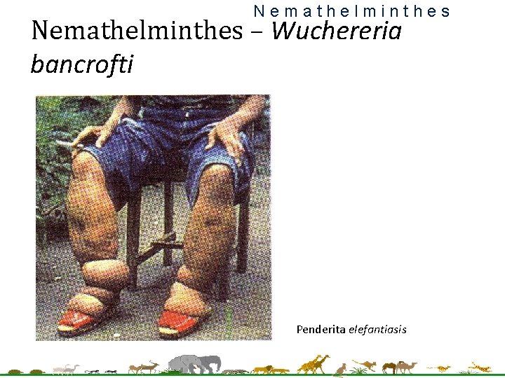 Nemathelminthes – Wuchereria bancrofti Penderita elefantiasis 