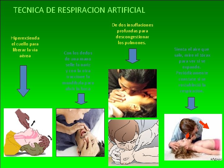 TECNICA DE RESPIRACION ARTIFICIAL Hiperextienda el cuello para liberar la vía aérea De dos