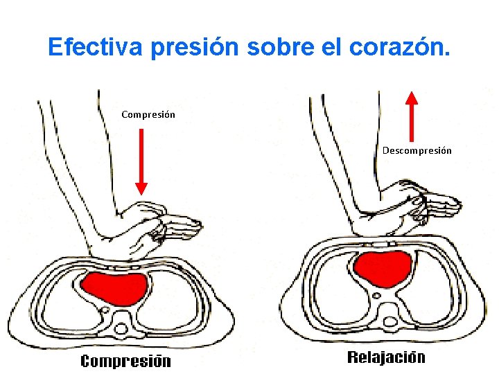 Efectiva presión sobre el corazón. Compresión Descompresión 