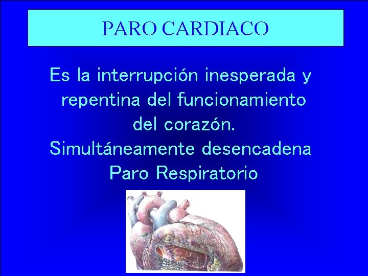 PARO CARDIACO Es la interrupción inesperada y repentina del funcionamiento del corazón. Simultáneamente desencadena