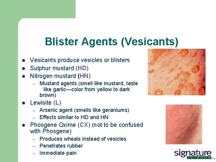 Blister Agents (Vesicants) l l l Vesicants produce vesicles or blisters Sulphur mustard (HD)
