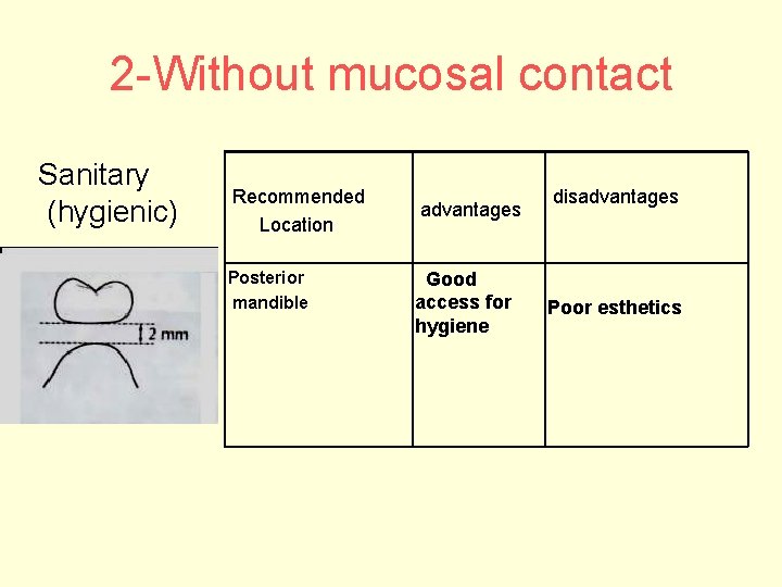 2 -Without mucosal contact Sanitary (hygienic) Recommended Location Posterior mandible advantages Good access for