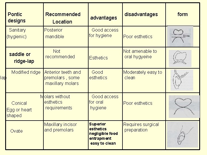 Pontic designs Recommended Location advantages Sanitary (hygienic) Posterior mandible Good access for hygiene Poor