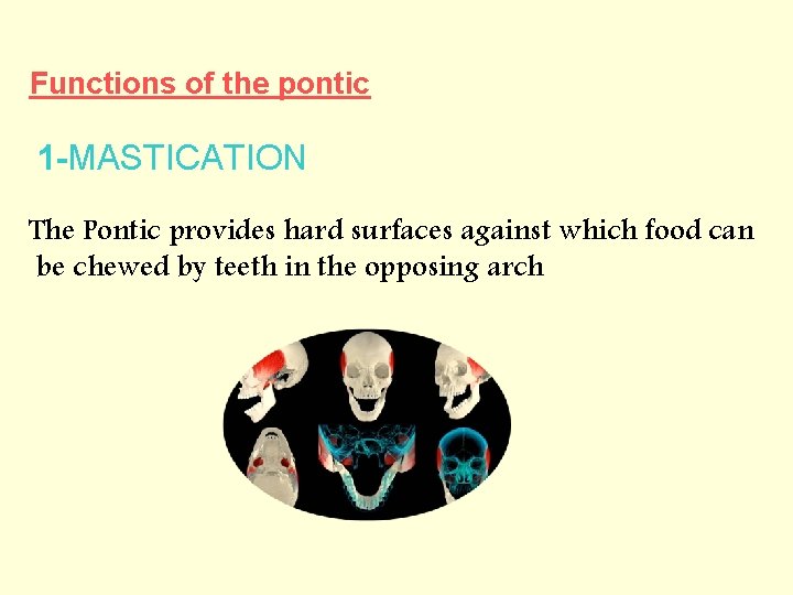Functions of the pontic 1 -MASTICATION The Pontic provides hard surfaces against which food