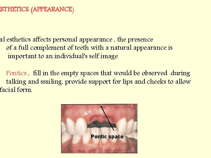 ESTHETICS (APPEARANCE) al esthetics affects personal appearance , the presence of a full complement