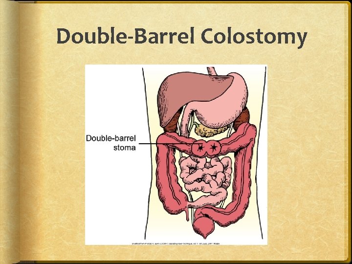 Chapter 46 Bowel Elimination Organs Of The Gastrointestinal