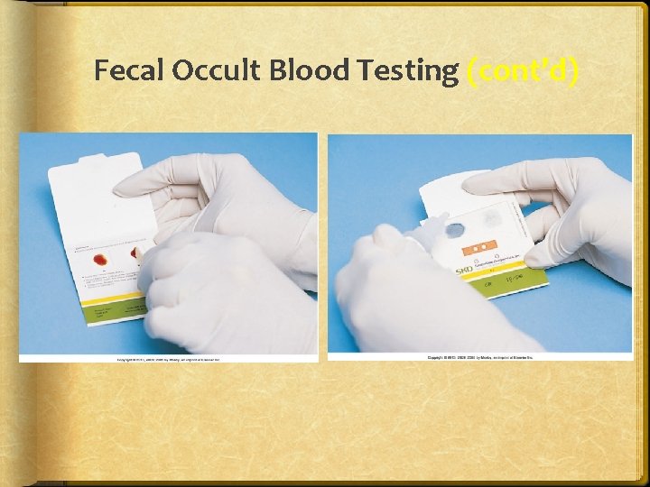 Fecal Occult Blood Testing (cont’d) 